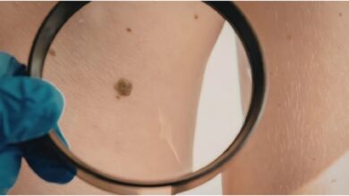 Skin Check Essentials in Melbourne: Ensuring Your Dermatological Well-being