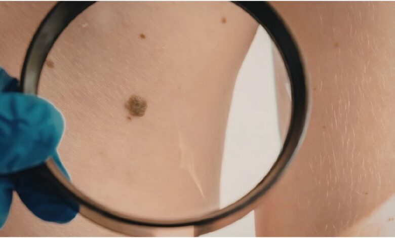 Skin Check Essentials in Melbourne: Ensuring Your Dermatological Well-being