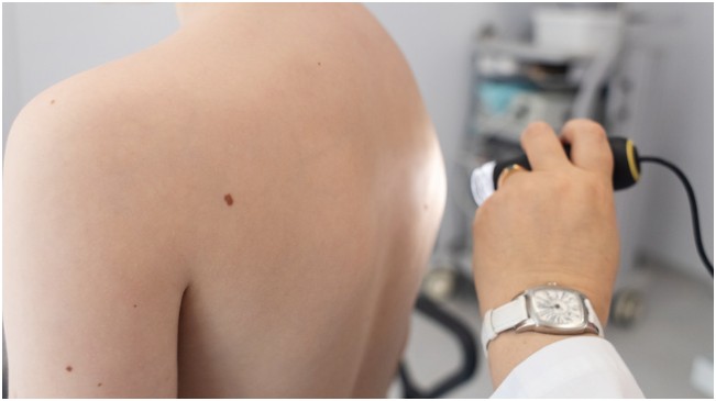 Understanding the Skin Check Process